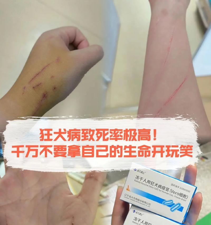 处理宠物狗被咬伤的方法（小狗被大狗咬伤后的急救和后续措施）