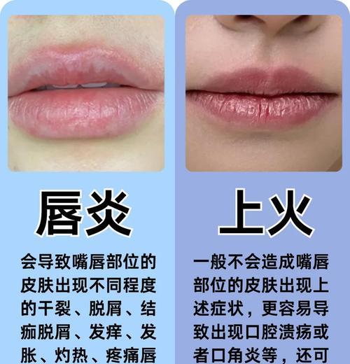 金毛嘴唇发红的原因及处理方法（了解金毛嘴唇发红的原因，保护宠物犬健康）